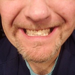 Meet your Posher, Gene